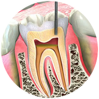 Endodontia