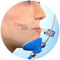 Ortopedia Facial Maxilar